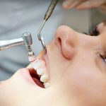 Népszerű a fogágybetegség kezelés