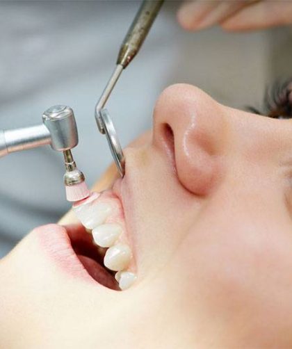 Népszerű a fogágybetegség kezelés